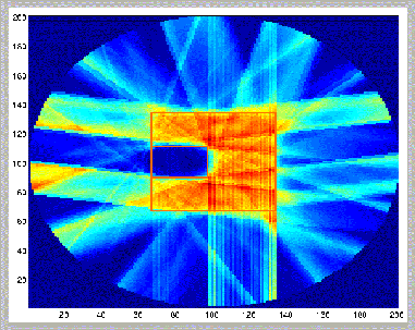 Image of optimization application in radiation therapy.