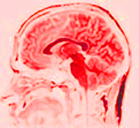 A magnetic resonance image of adult human brain.