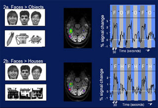 Comparison of sample fMRI scans of the brains of subjects.