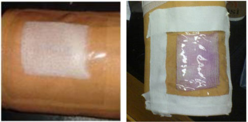 Two photos of bandages under clear wrap; one in which the wrap is itself adhesive, and one that's affixed using separate packing tape.