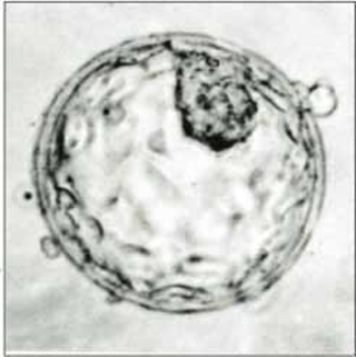 Human blastocyst showing inner cell mass and trophectoderm.